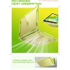 image:imageSUPCASE for MacBook Neo Case 13 Inch 2026 Unicorn Beetle Model A3404 A18 Pro Chip Heavy Duty Rugged MilitaryGrade Protection AntiScratch Hard Shell Protective Cover for MacBook Neo 13 IndigoCitrus